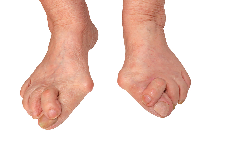 Foot Care Services New York