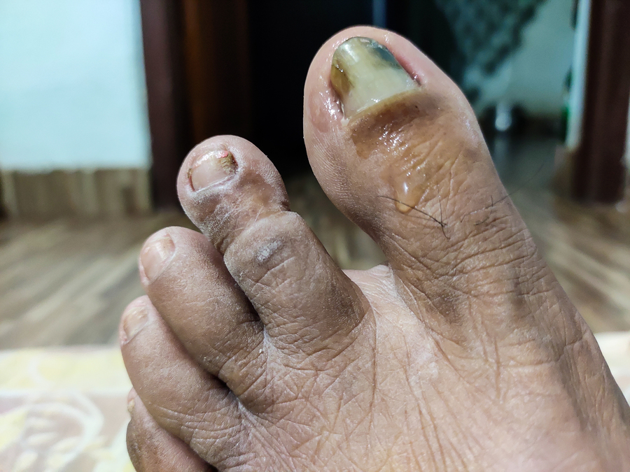 Foot Care Services New York